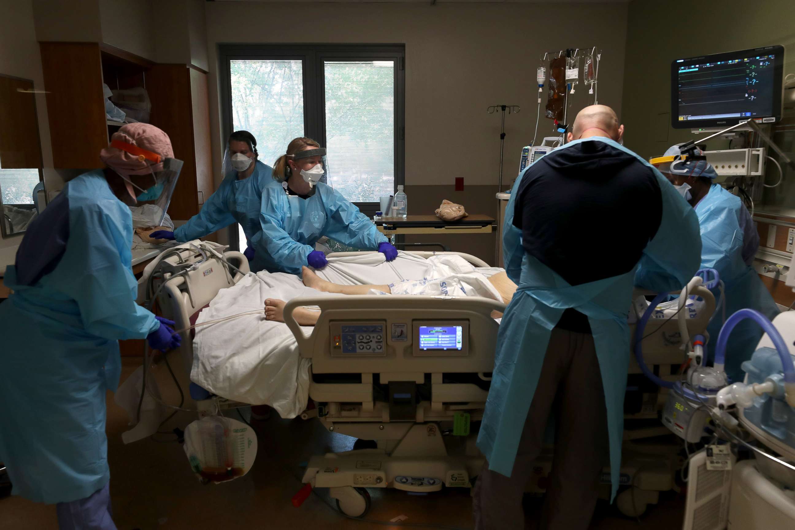 PHOTO: Nurses care for a coronavirus patient in the intensive care unit at Regional Medical Center on May 21, 2020, in San Jose, Calif.