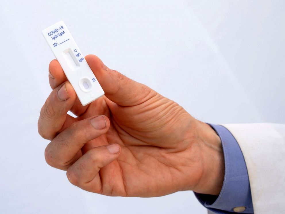 PHOTO: Dr. Matthew Budoff shows a COVID-19 antibody test at the Diagnostic and Wellness Center, May 5, 2020, in Torrance, Calif.