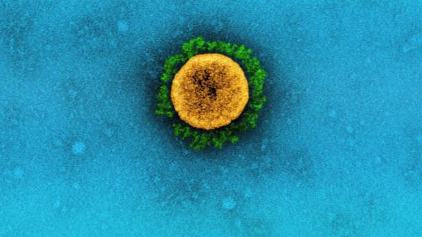 Transmission electron micrograph of a SARS-CoV-2 virus particle (UK B.1.1.7 variant), isolated from a patient sample and cultivated in cell culture. SARS-CoV-2, also known as the novel coronavirus, is a virus that causes COVID-19, a respiratory illness.