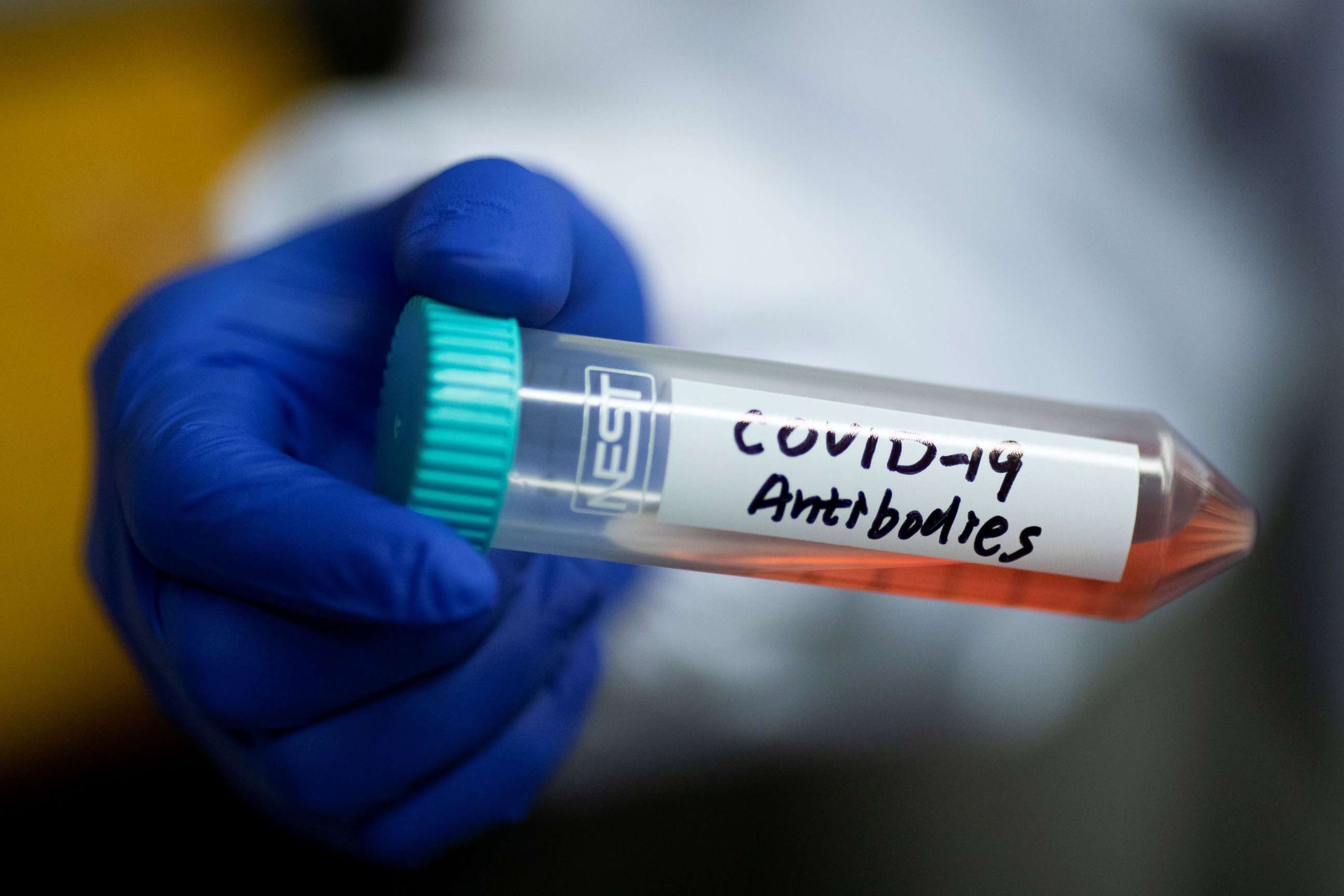 PHOTO: Scientist Linqi Zhang shows a tube with a solution containing COVID-19 antibodies in his lab where he works on research into novel coronavirus disease antibodies for possible use in a drug in Beijing, China, March 30, 2020. 