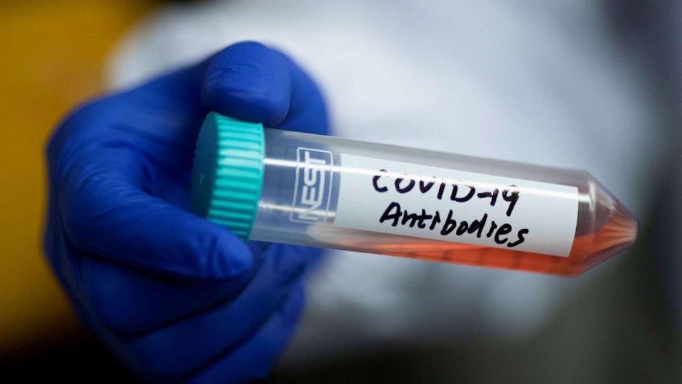 PHOTO: Scientist Linqi Zhang shows a tube with a solution containing COVID-19 antibodies in his lab where he works on research into novel coronavirus disease antibodies for possible use in a drug in Beijing, China, March 30, 2020. 