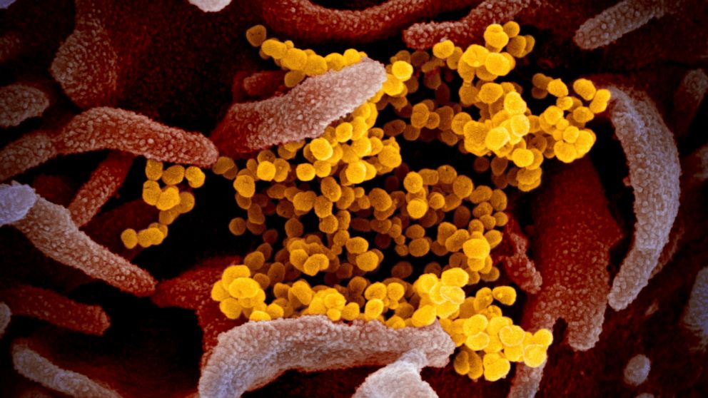 PHOTO: An electron microscope image made available by the U.S. National Institutes of Health in February 2020 shows the novel coronavirus SARS-CoV-2, yellow, emerging from the surface of cells, pink, cultured in the lab. The virus causes COVID-19.