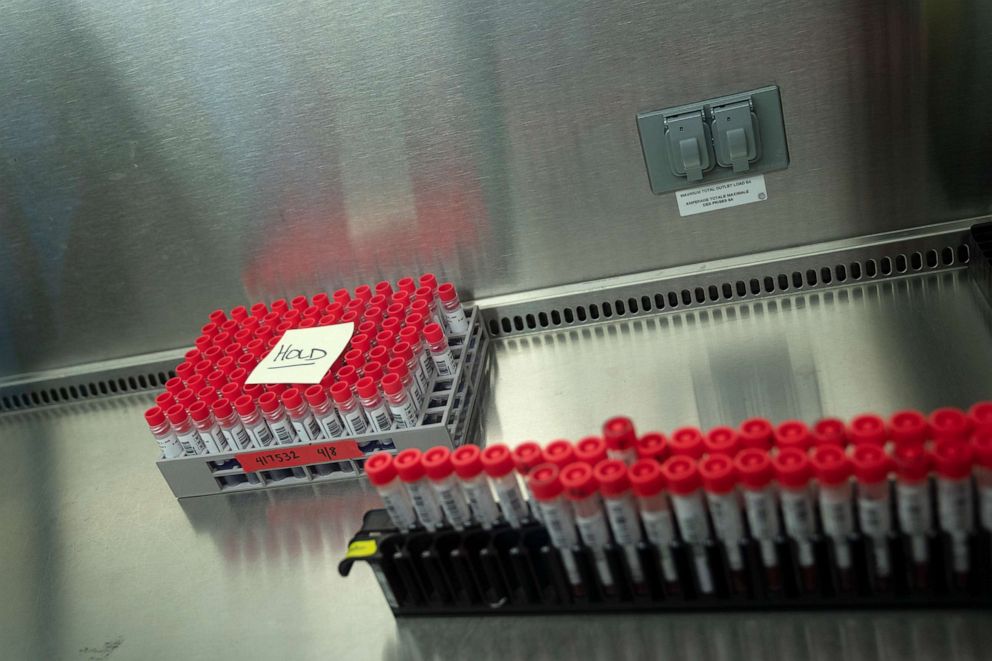 PHOTO: Vials containing positive Covid test results await processing to discern variants that are rapidly spreading throughout the United States at the University of Maryland School of Medicine, April 9, 2021, in Baltimore.