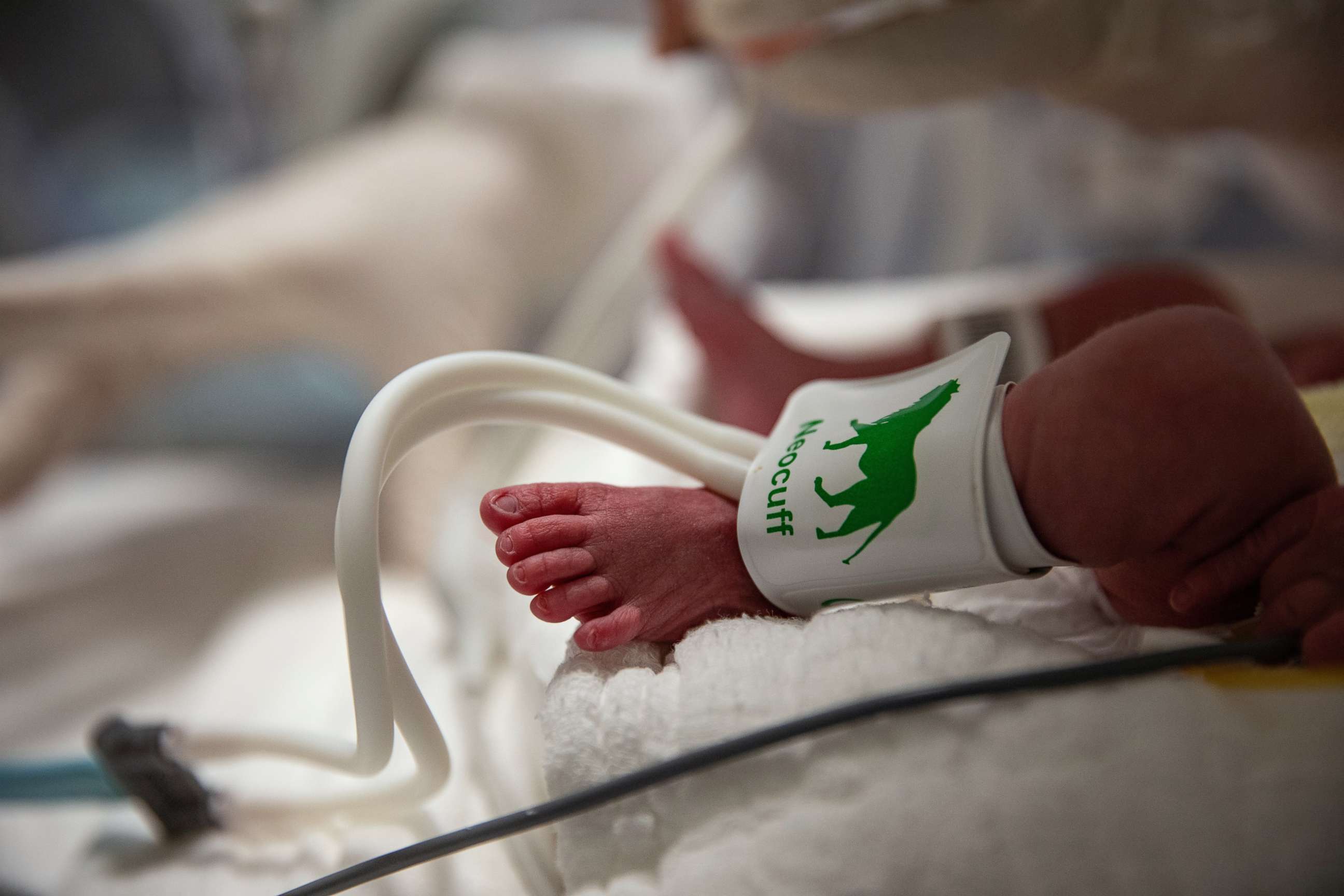 PHOTO: An infant with COVID-19 is pictured at University of Health Sciences Training and Research Hospital in Istanbul, Turkey on April 15, 2021.