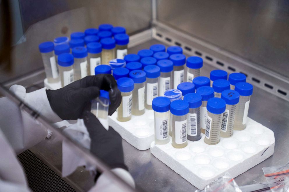 PHOTO: A lab technician tests wastewater samples from around the United States for the coronavirus disease (COVID-19) at the Biobot Analytics, in Cambridge, Massachusetts, Feb. 22, 2022.