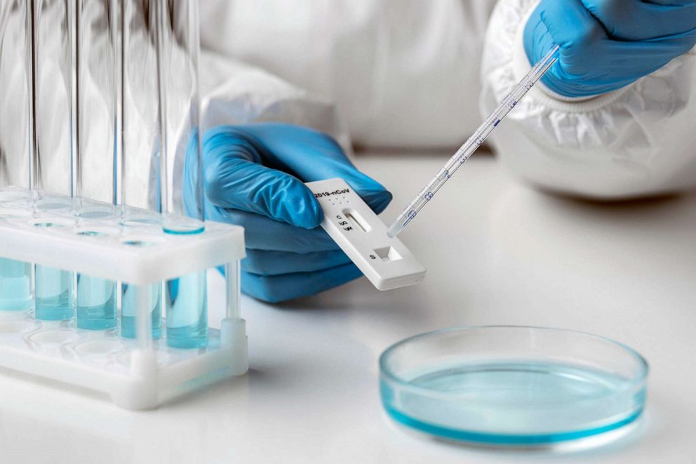 STOCK PHOTO: Covid test