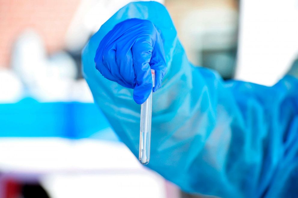 PHOTO: A health worker holds up a test tube with a COVID-19 test sample taken from someone at Revere Beach in Revere, Massachusetts, on Aug. 11, 2020.