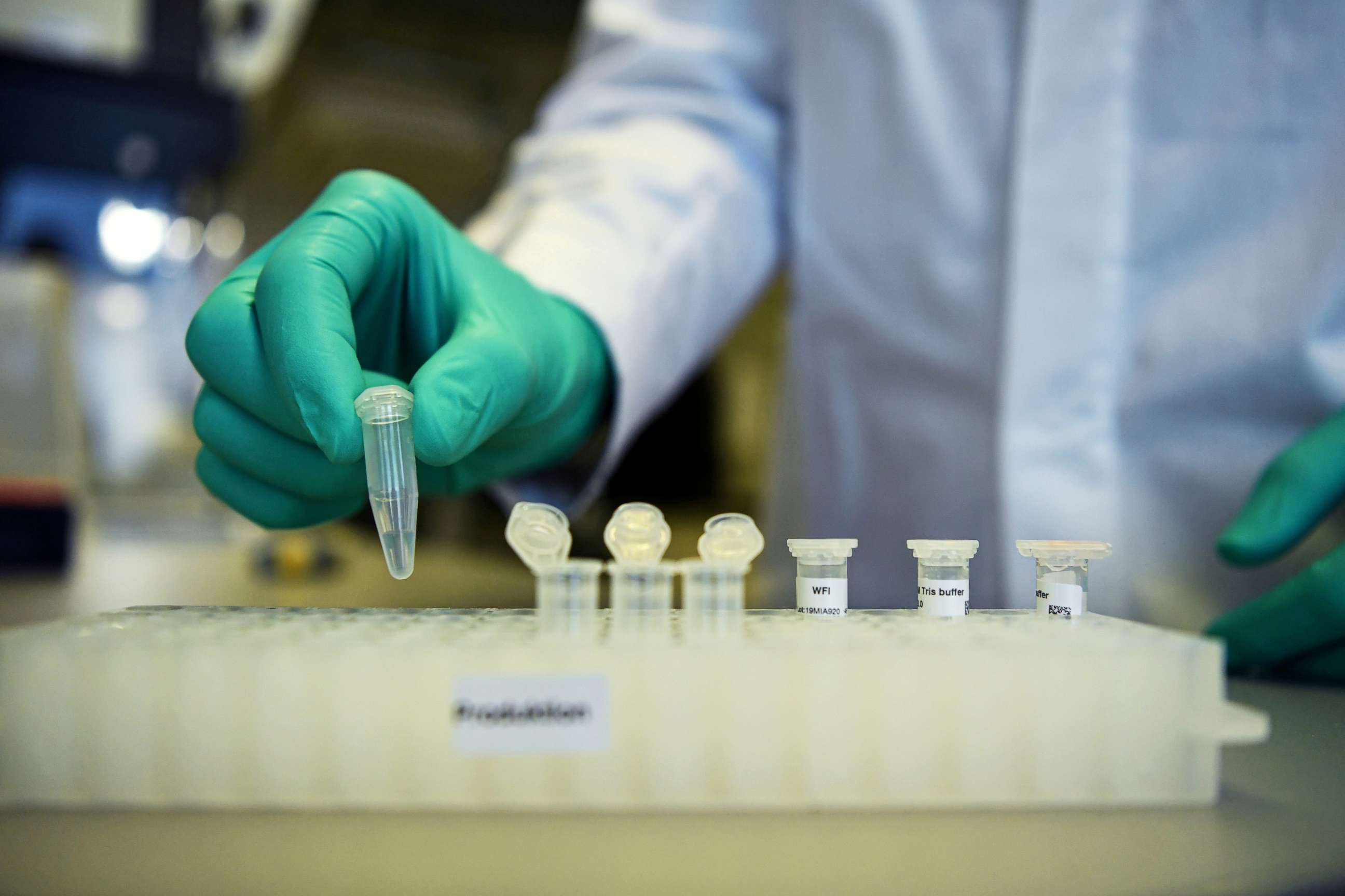 PHOTO: An employee of German biopharmaceutical company CureVac, demonstrates research workflow on a vaccine for the coronavirus (COVID-19) disease at a laboratory in Tuebingen, Germany, March 12, 2020. 