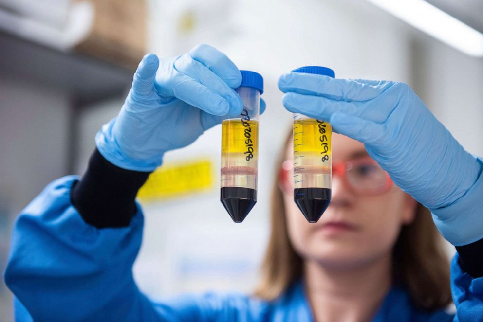 PHOTO: In this undated photo issued by the University of Oxford, a researcher in a laboratory at the Jenner Institute works in Oxford, England, works on the COVID-19 vaccine developed by AstraZeneca and the University of Oxford.