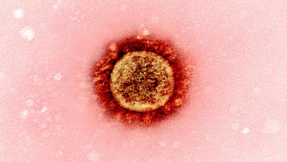 PHOTO: Transmission electron micrograph of a SARS-CoV-2 virus particle (UK B.1.1.7 variant), isolated from a patient sample and cultivated in cell culture. Image captured at the NIAID Integrated Research Facility (IRF) in Fort Detrick, Md.
