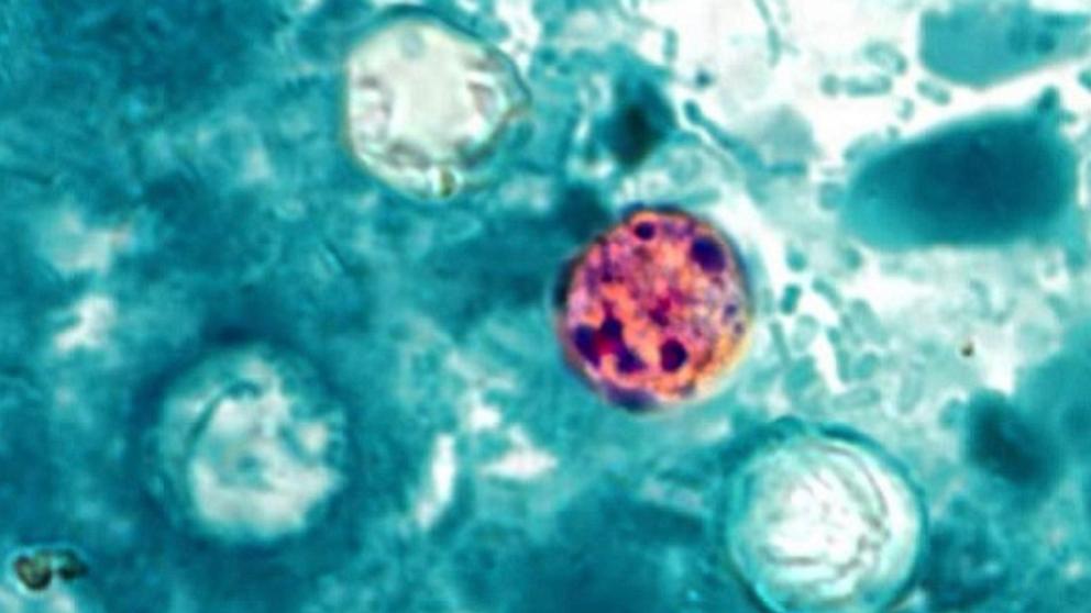 PHOTO: Cyclospora cayetanensis is a unicellular parasite that causes an intestinal infection called cyclosporiasis. 