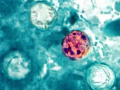 What to know about Taylor Farms amid cyclosporiasis outbreak