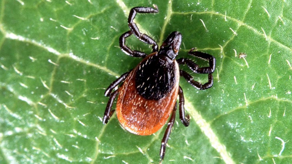 PHOTO: A deer tick is pictured in this undated stock photo.