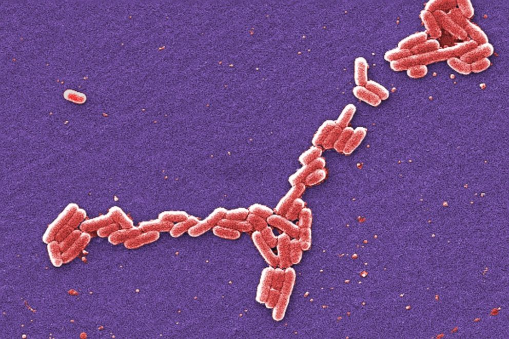 This colorized scanning electron microscope image from 2006 shows an E. coli strain of the O157: H7 strain that produces a potent toxin that can cause disease.