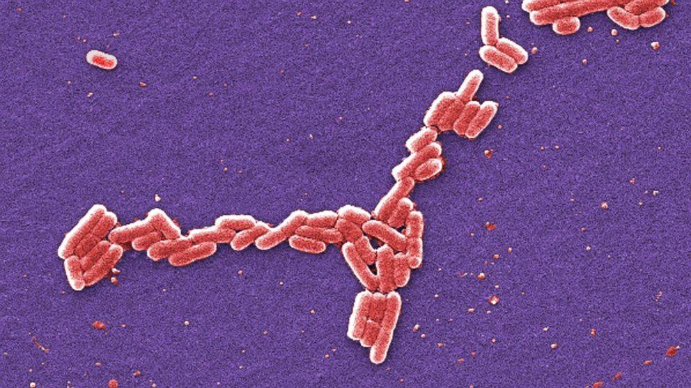 PHOTO: This colorized 2006 scanning electron microscope image made available by the Centers for Disease Control and Prevention shows E. coli bacteria of the O157:H7 strain that produces a powerful toxin which can cause illness.