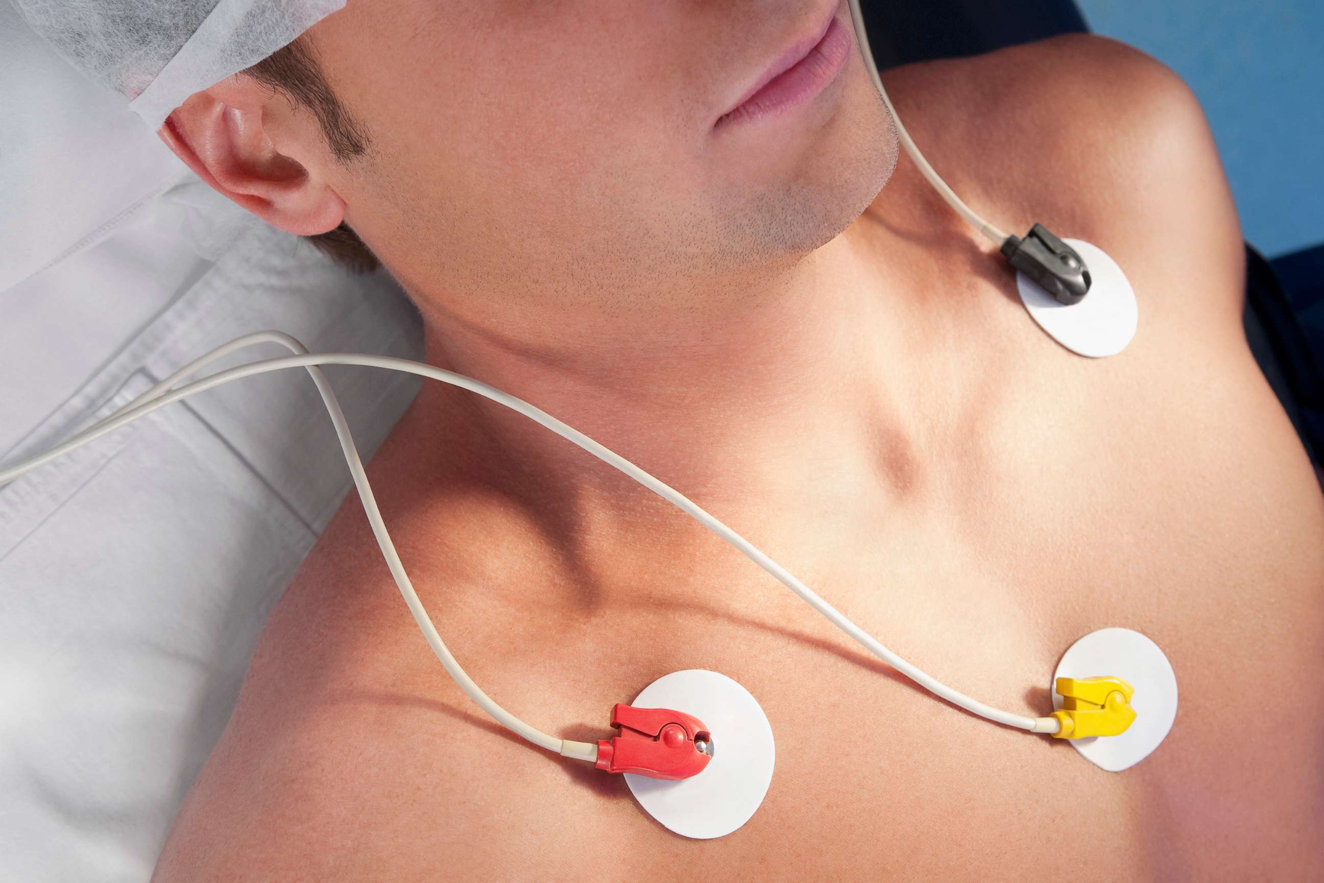 PHOTO: A person appears to take an electrocardiogram test in this stock photo.