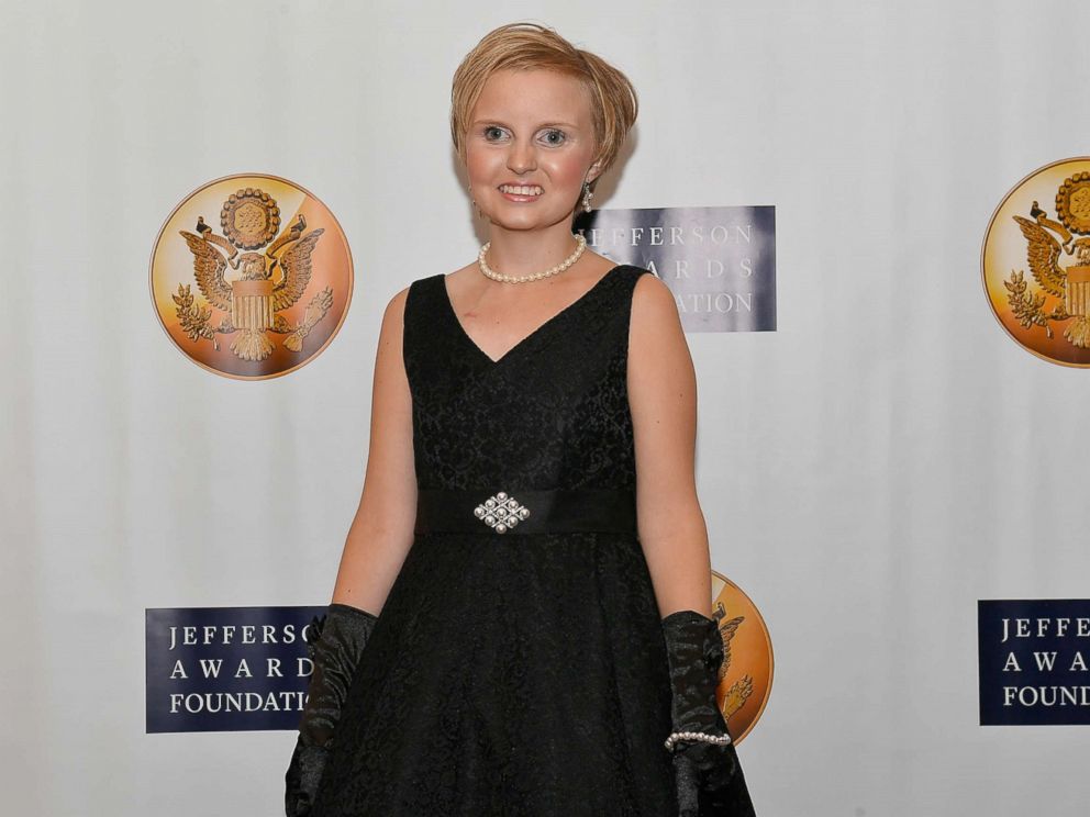 PHOTO: Emma Stumpf, LEAD360 winner 2017, attends The Jefferson Awards Foundation 2017 DC National Ceremony at Capital Hilton, June 22, 2017, in Washington.