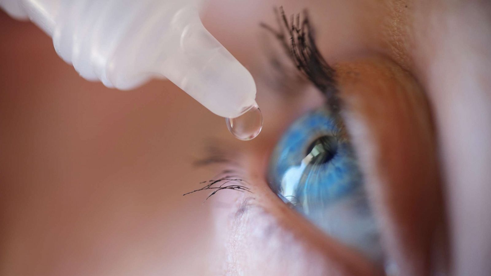 PHOTO: A woman puts an eye drop in to her eye in this undated stock photo.