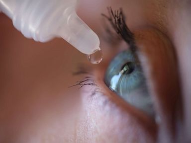 FDA sends letters to CVS, Walgreens, other companies about unapproved eye products