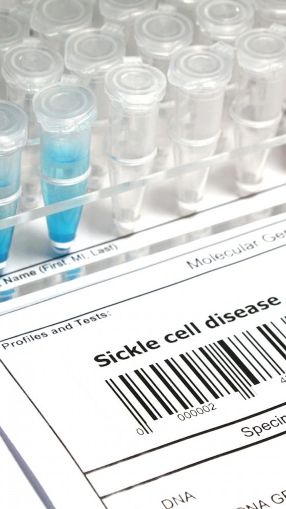 FDA approves gene therapies for sickle cell disease, a 'functional cure ...