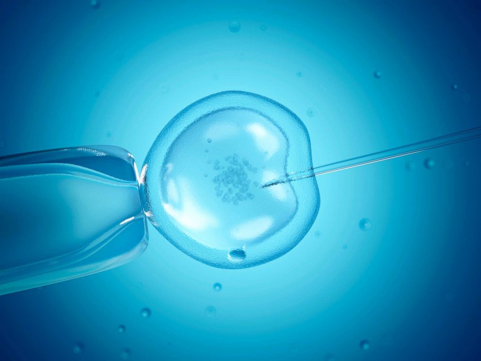 PHOTO: An in vitro fertilization computer illustration is seen here.