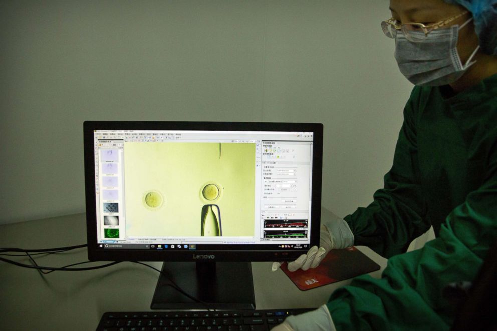 PHOTO: In this Oct. 9, 2018 photo, Zhou Xiaoqin adjusts a monitor showing a video feed of a fine glass pipette containing Cas9 protein and PCSK9 sgRNA to an embryo under a microscope at a laboratory in Shenzhen in southern China's Guangdong province.