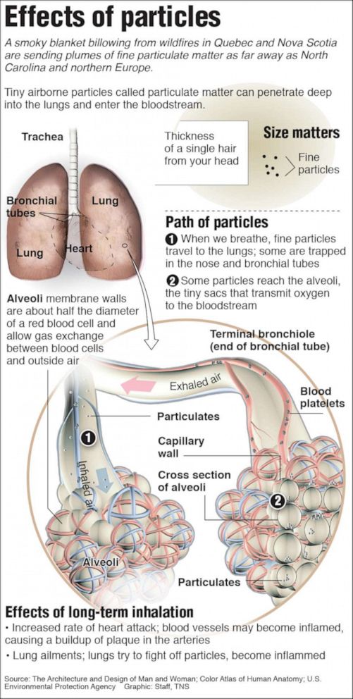 PHOTO: A graphic shows the damage particulate matter can do to your lungs.
