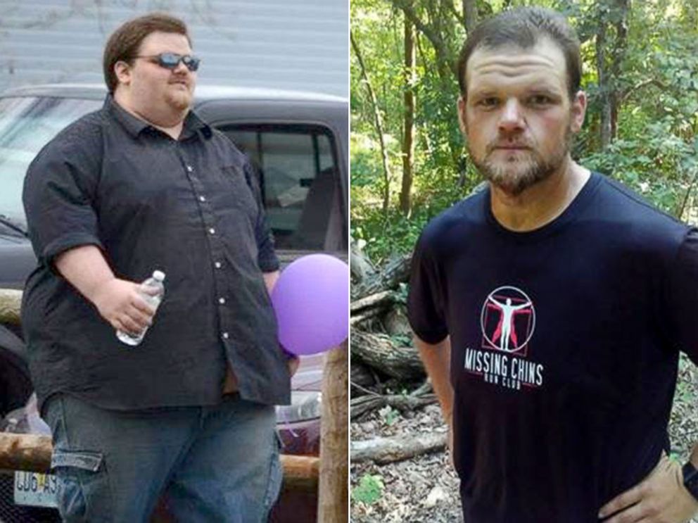 PHOTO: Justin Lacy is pictured before and after the weight loss he achieved as a member of the "Missing Chins Run Club."