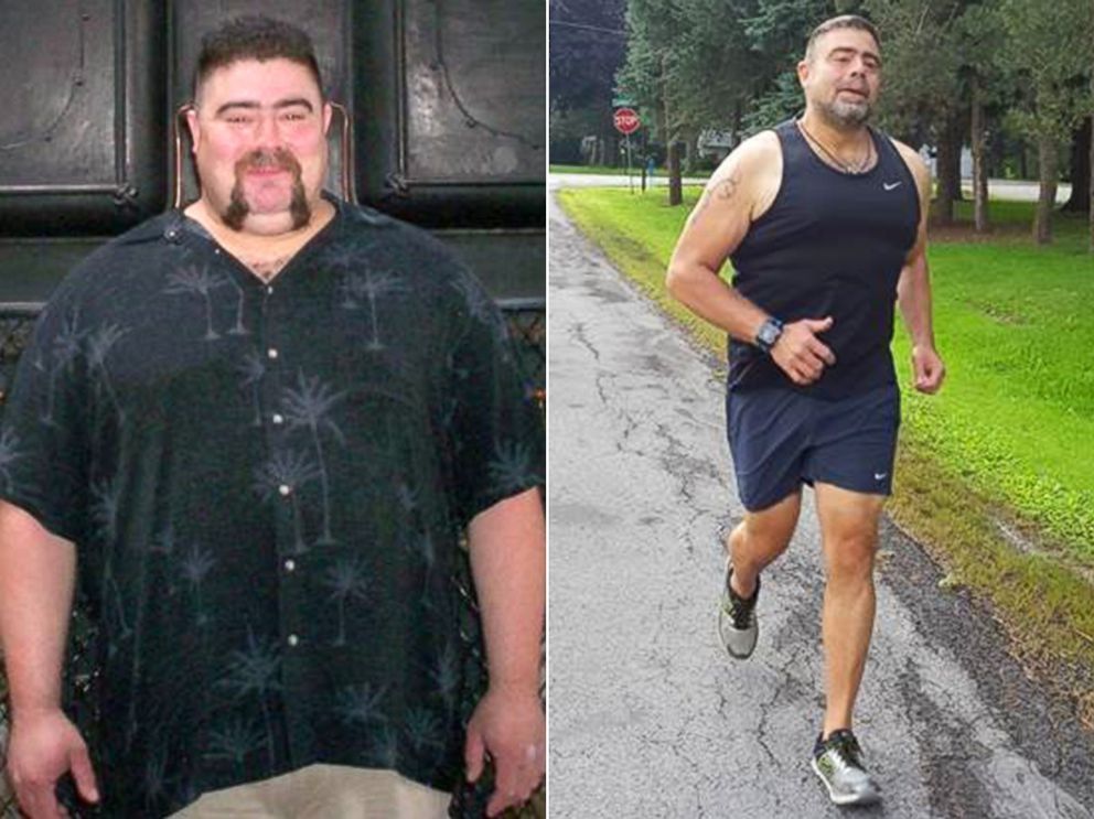 PHOTO: Tim Kaufman is pictured before and after the weight loss he achieved as a member of the "Missing Chins Run Club."