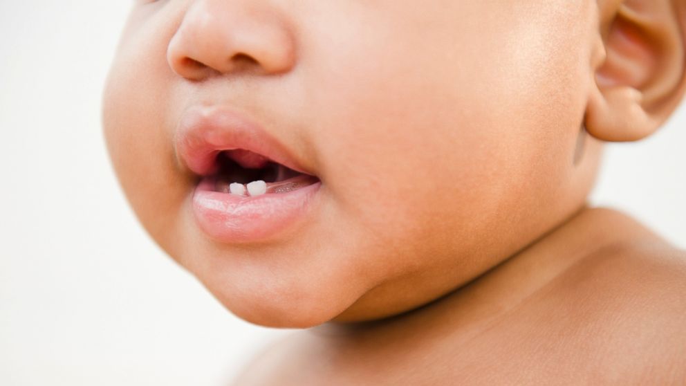 An infant's baby teeth are seen in an undated stock photo.