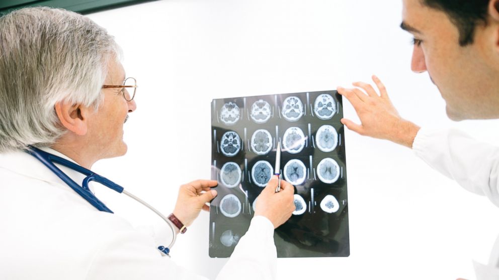 Doctors consult over an MRI scan of the brain in an undated stock photo.