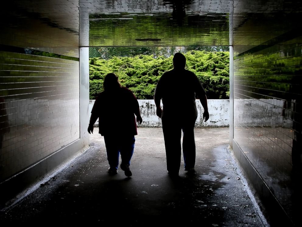 PHOTO: Many health problems accompany obesity.