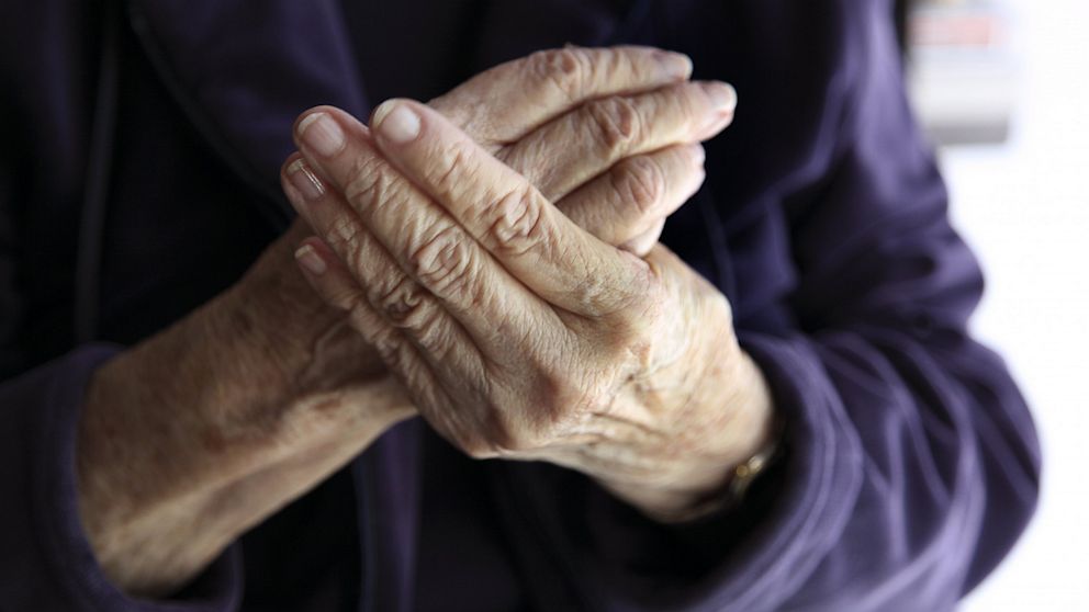 Numbness or tingling in the hands can be a sign of rheumatoid arthritis.