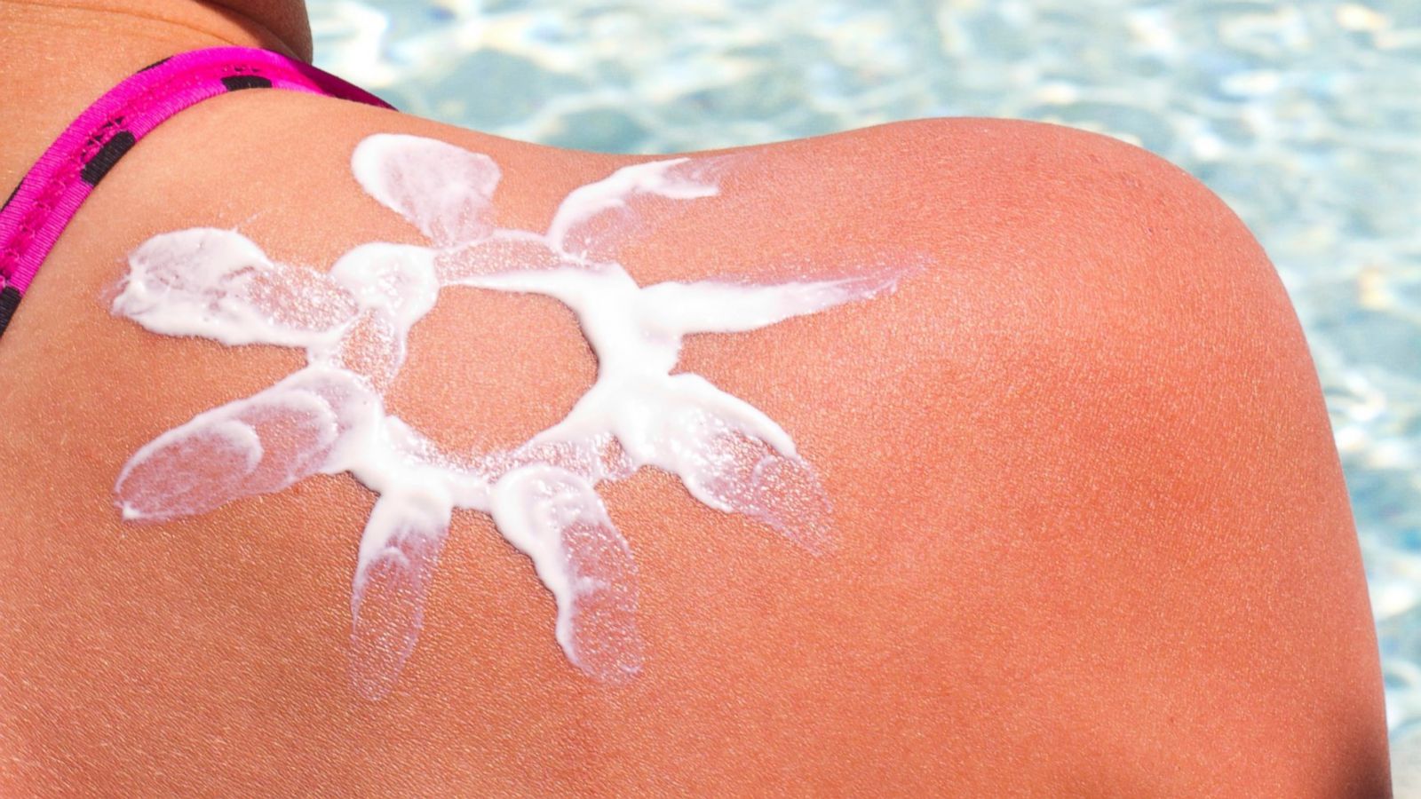 People are getting sunburned on purpose for sunburn tattoos