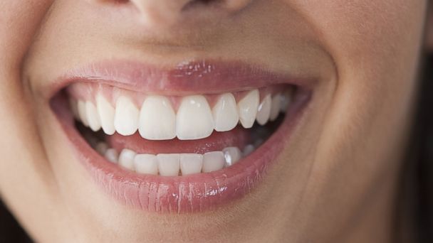 10 Mistakes You're Making With Your Teeth - ABC News