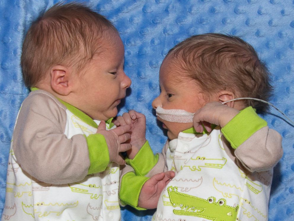 PHOTO: Tyler and Aaron born at Saint Luke's East Hospital in Lee's Summit, Missouri.