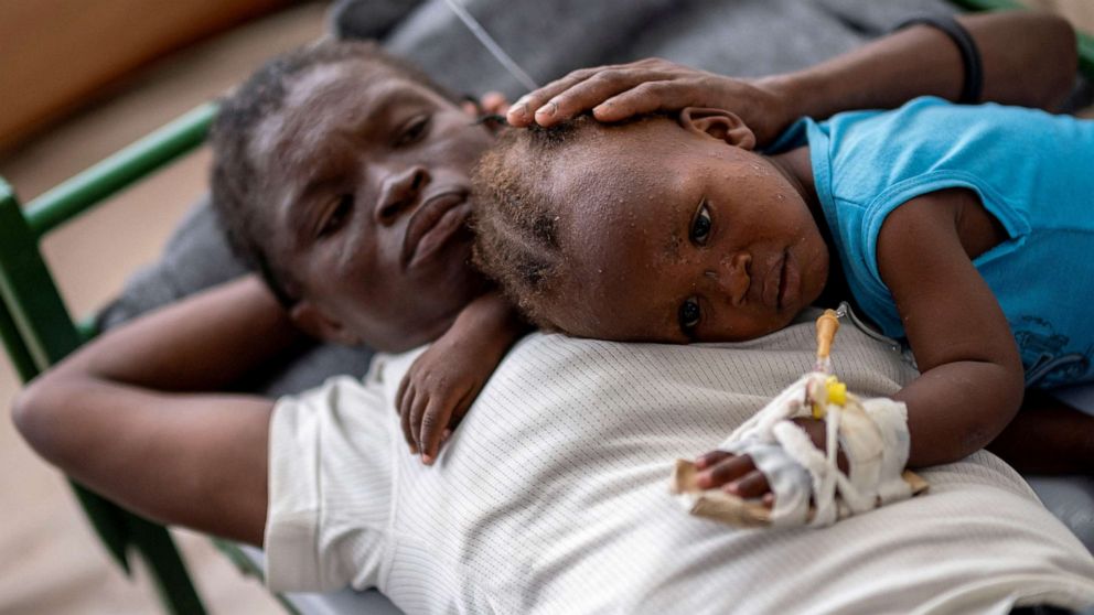 FOTO: Karina Joseph, 19, troost haar 2-jarige kind Holanda Sineus terwijl ze wordt behandeld voor cholera in een tent in een ziekenhuis van Artsen zonder Grenzen in Cite Soleil, een dichtbevolkte gemeente van Port-au-Prince, Haïti, Octt .  15, 2022.
