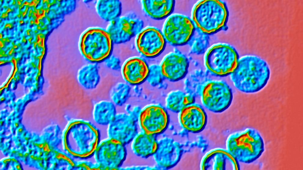 PHOTO: Stock photo of a colorized electron micrograph of the Hantavirus.