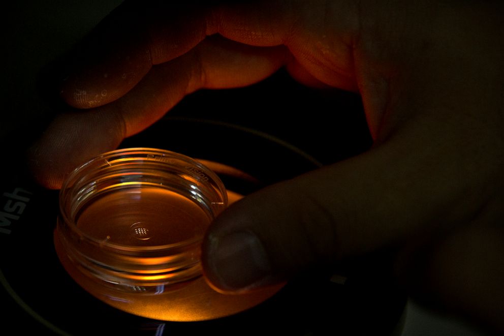 PHOTO: An embryologist who was part of the team working with scientist He Jiankui adjusts a microplate containing embryos at a lab in Shenzhen in southern China's Guandong province, Oct. 9, 2018.