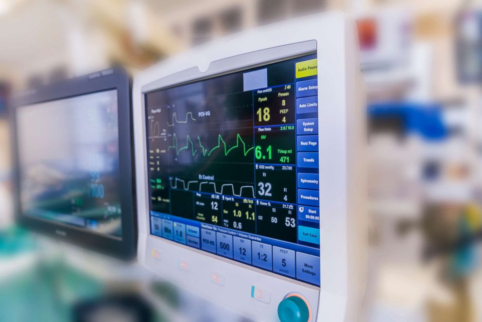 PHOTO: Monitors in the operating room during heart valve replacement surgery.