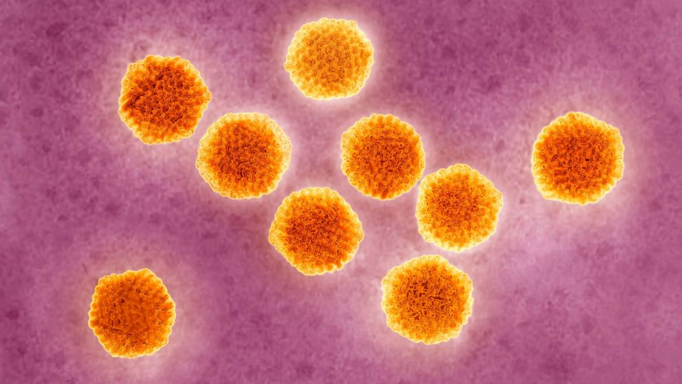 PHOTO: Hepatitis A virus.