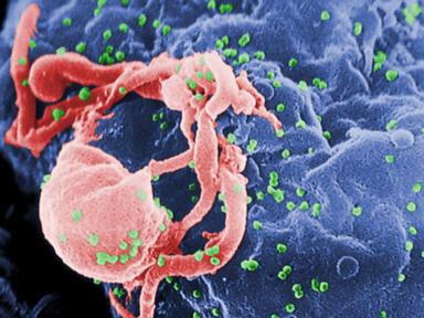 4 children surpass a year of HIV remission after treatment pause: Study
