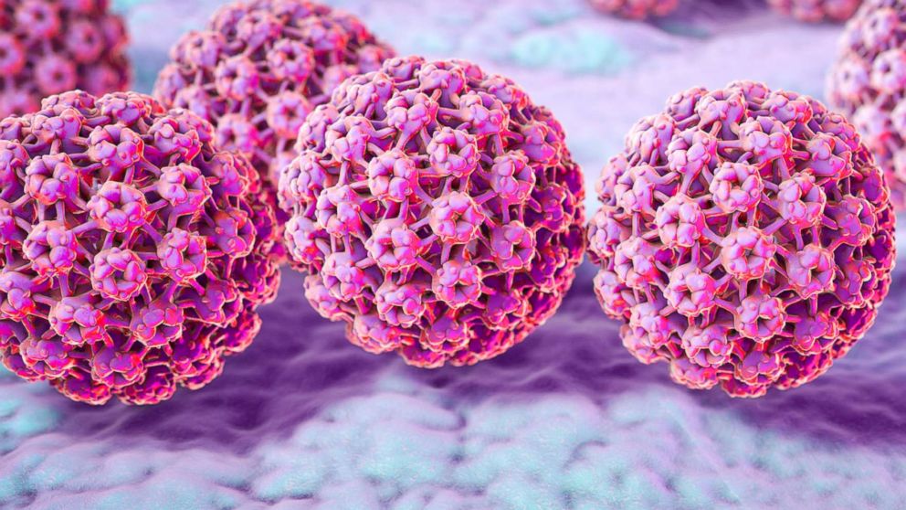 PHOTO: A computer illustration of human papilloma virus (HPV) is pictured in this undated photo.