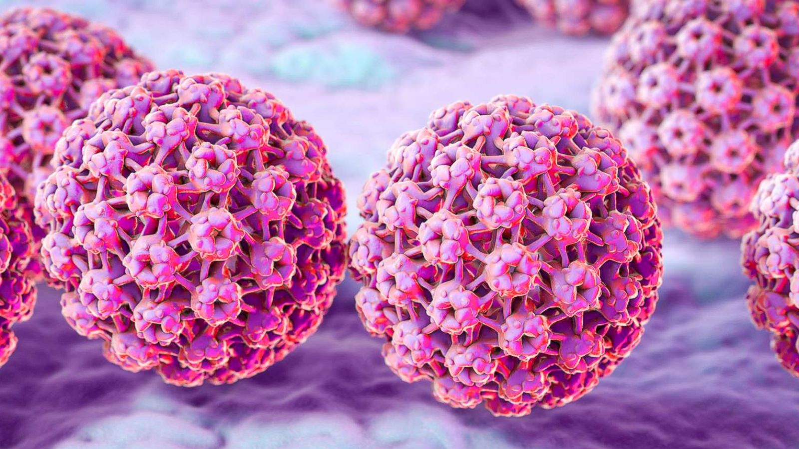 PHOTO: A computer illustration of human papilloma virus (HPV) is pictured in this undated photo.