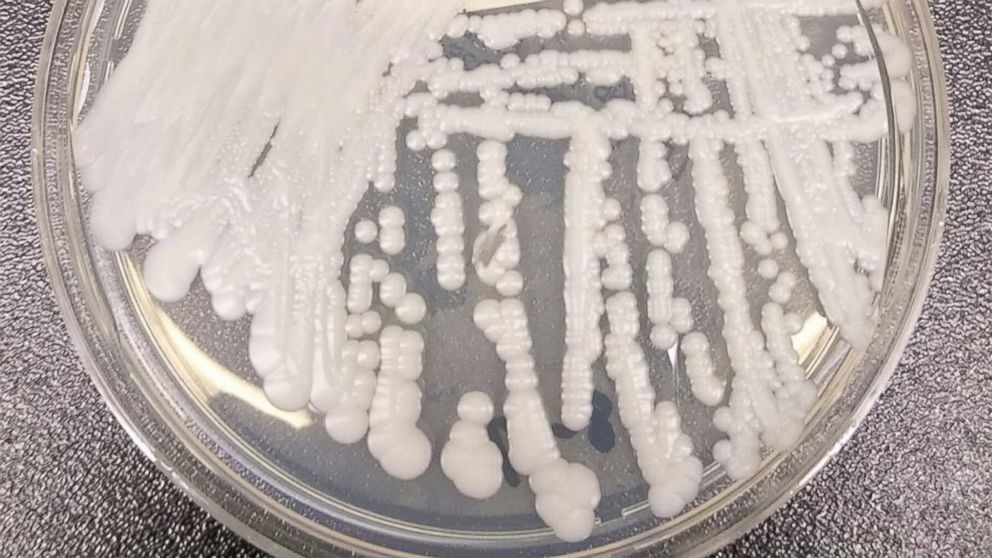 PHOTO: The CDC announced on Nov. 4, 2016 that at least 13 cases of a fungal infection called Candida auris (C.auris) have been reported in the U.S.