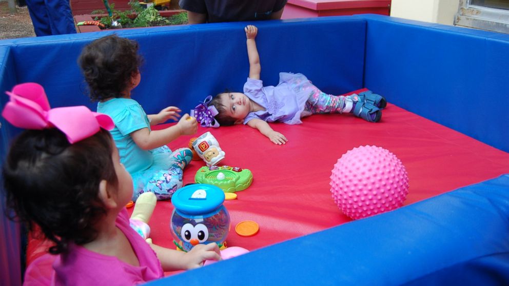 Both girls are doing well in recovery nearly a year after their surgery. 