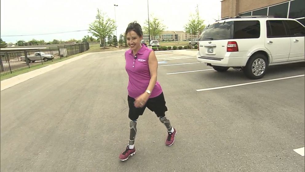 PHOTO: Yvonne Llanes of Yuma, Arizona, stopped using her wheelchair after 10 years. She credited her love of her father and the Hanger Clinic double above-knee amputee boot camp for giving her the motivation to be mobile.