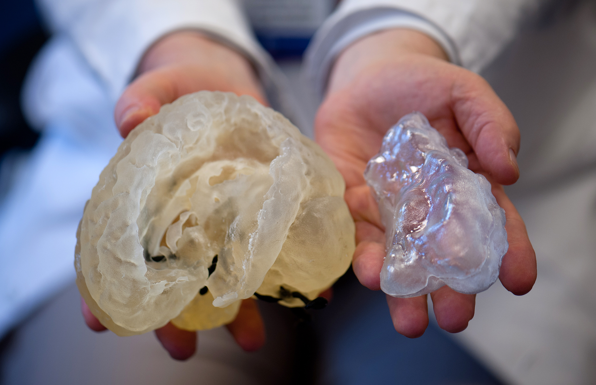 PHOTO: A doctor holds up 3D printed organs, which are used to help doctors practice for their surgeries at Boston Children's Hospital.

