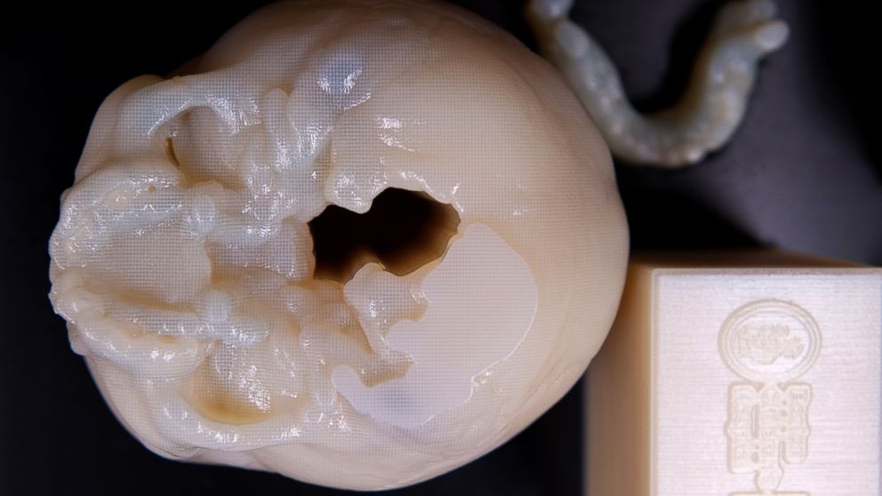 PHOTO: This 3D-printed objects helps simulate the real thing before doctors operate on their pint-sized patients.
