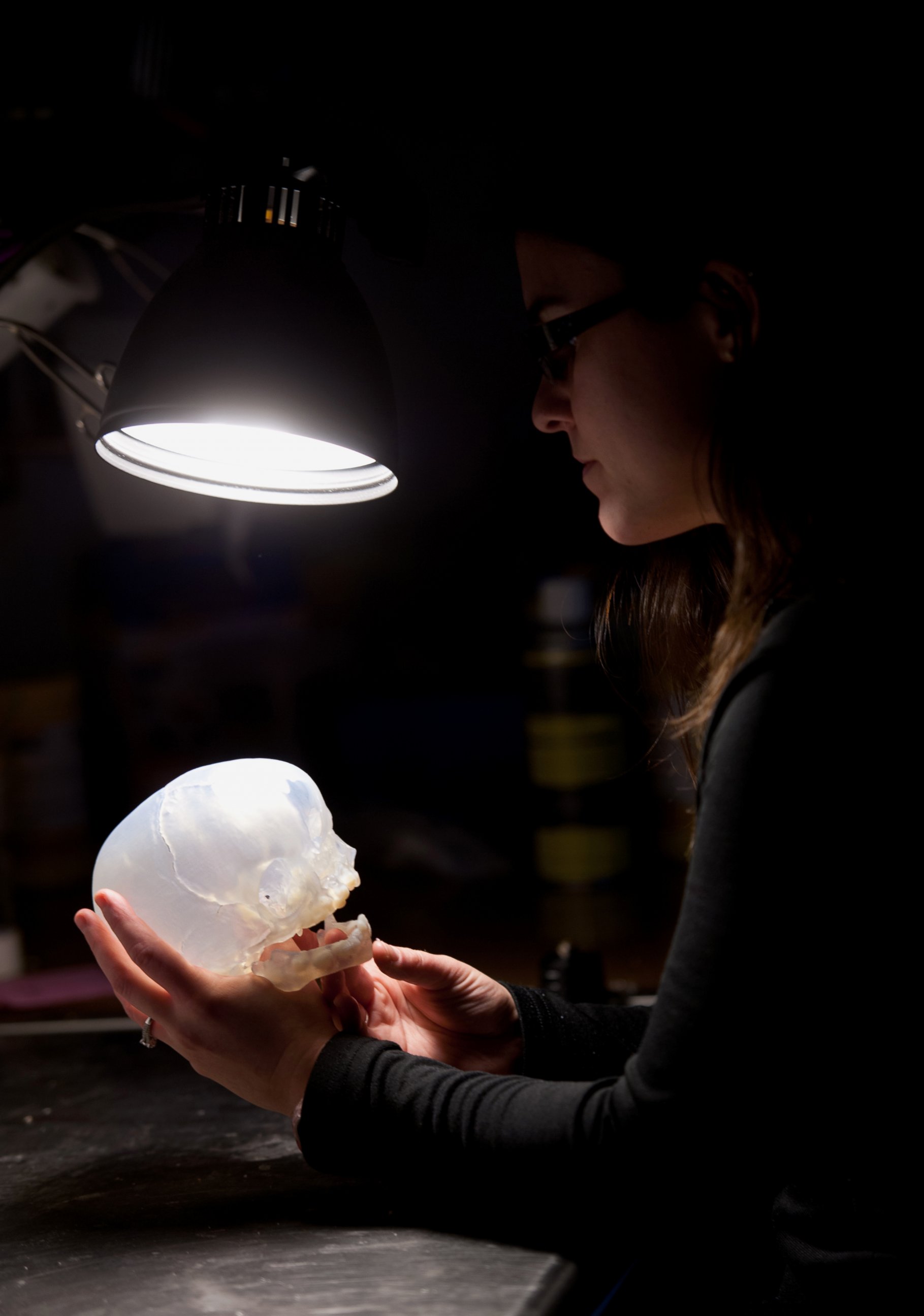PHOTO: This replica of a patient's skull can be critical acts as a guide to help surgeons prepare for their surgeries.
